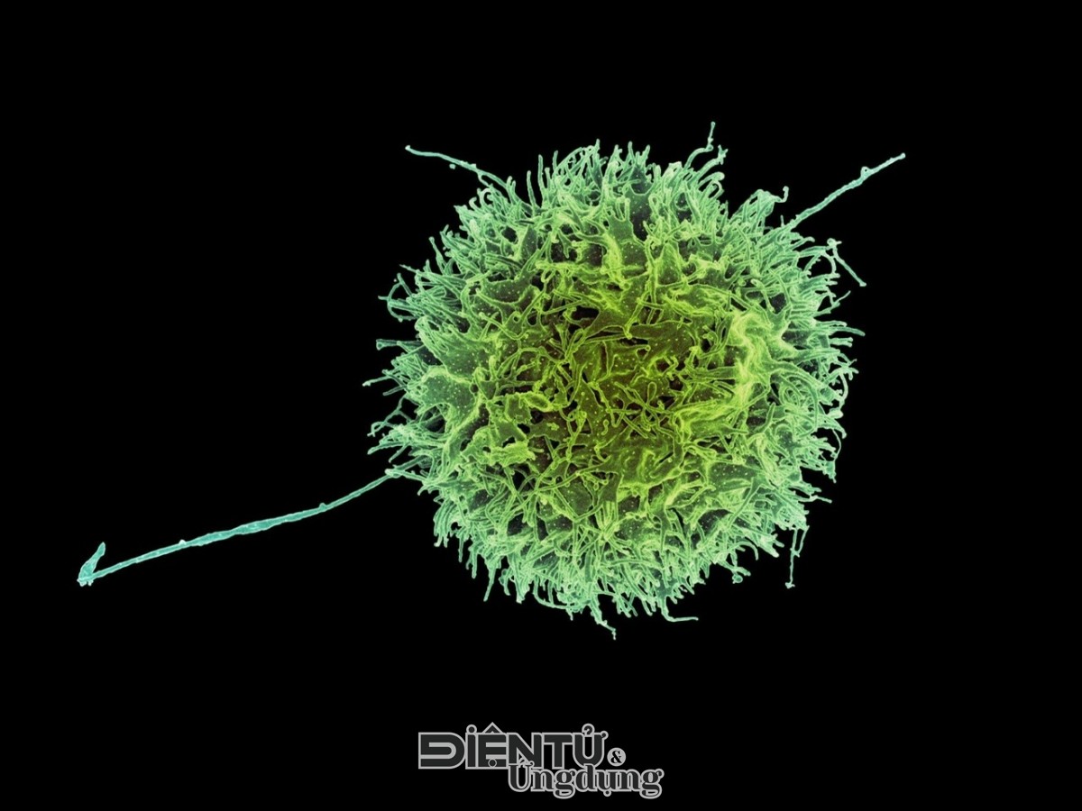 Đại học Monash phát hiện cơ chế tăng sức mạnh cho tế bào tiêu diệt ung thư