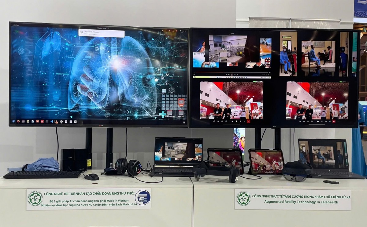 Trường Đại học Công nghệ kết hợp với Bệnh viện Bạch Mai phát triển hệ thống AI chẩn đoán sớm ung thư phổi