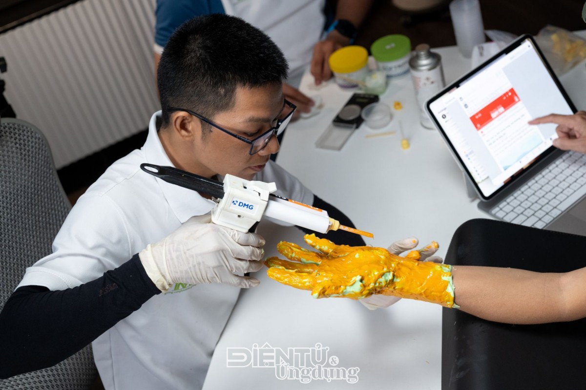 Phục hình thẩm mỹ silicone ‘made in Vietnam’, cơ hội mới cho người khuyết tật