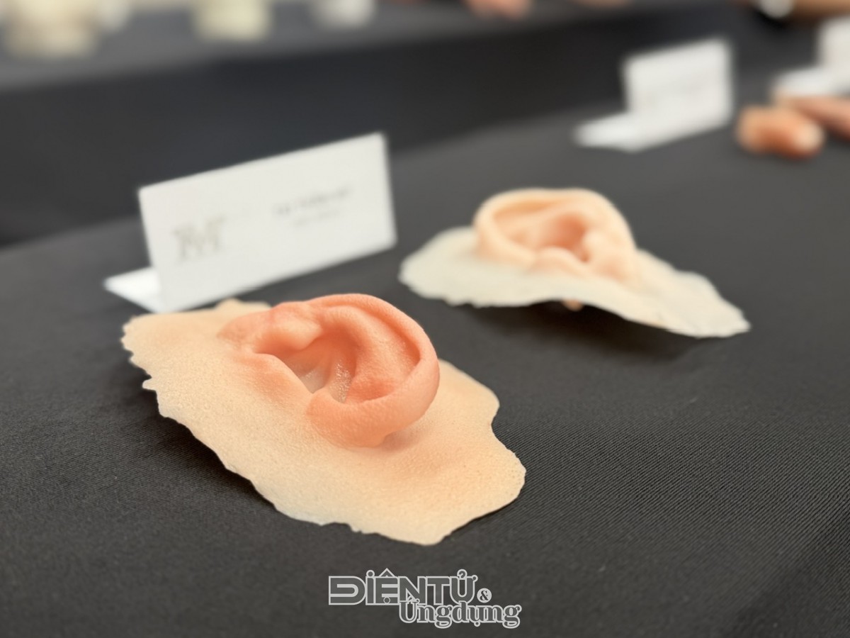 Phục hình thẩm mỹ silicone ‘made in Vietnam’, cơ hội mới cho người khuyết tật