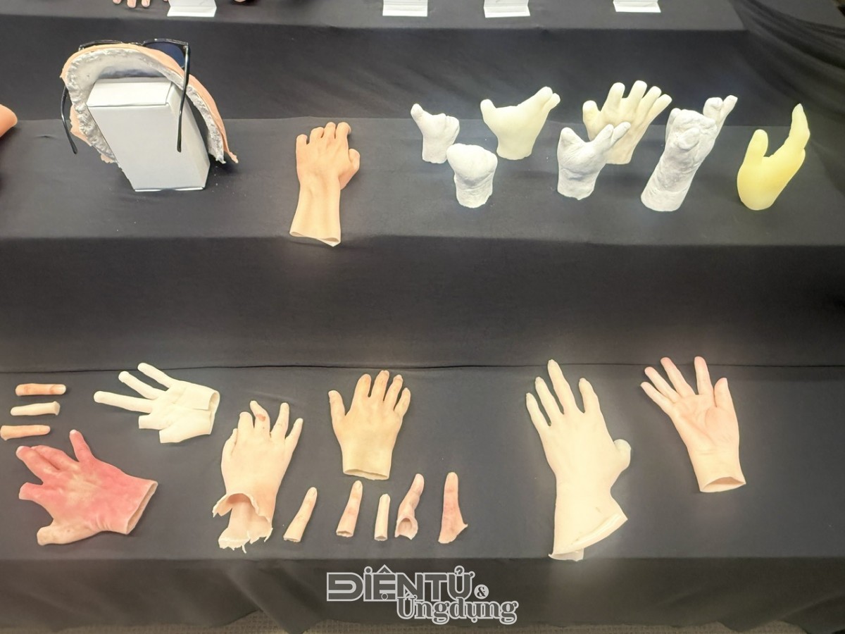 Phục hình thẩm mỹ silicone ‘made in Vietnam’, cơ hội mới cho người khuyết tậtPhục hình thẩm mỹ silicone ‘made in Vietnam’, cơ hội mới cho người khuyết tật