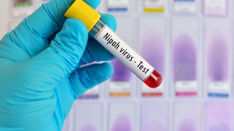 Nhận diện đúng nguy cơ để phòng ngừa hiệu quả virus Nipah