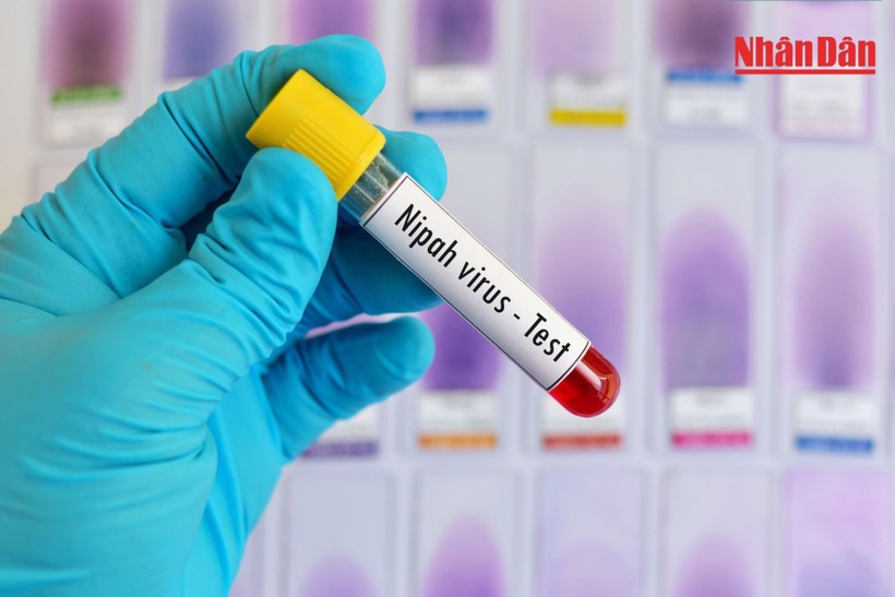 Nhận diện đúng nguy cơ để phòng ngừa hiệu quả virus Nipah