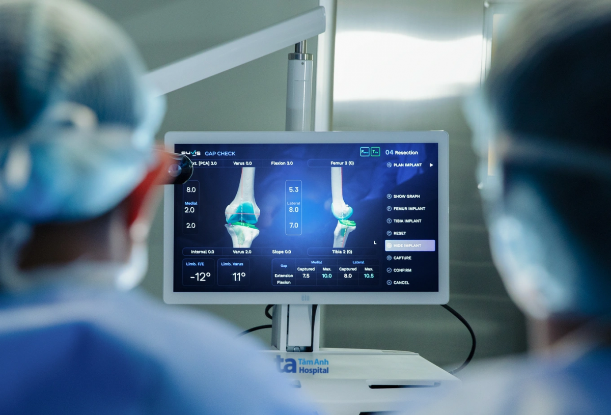 Phần mềm CUVIS-Joint hỗ trợ bác sĩ kiểm soát và cân bằng cấu trúc khớp trong phẫu thuật (Ảnh: BVĐK Tâm Anh)