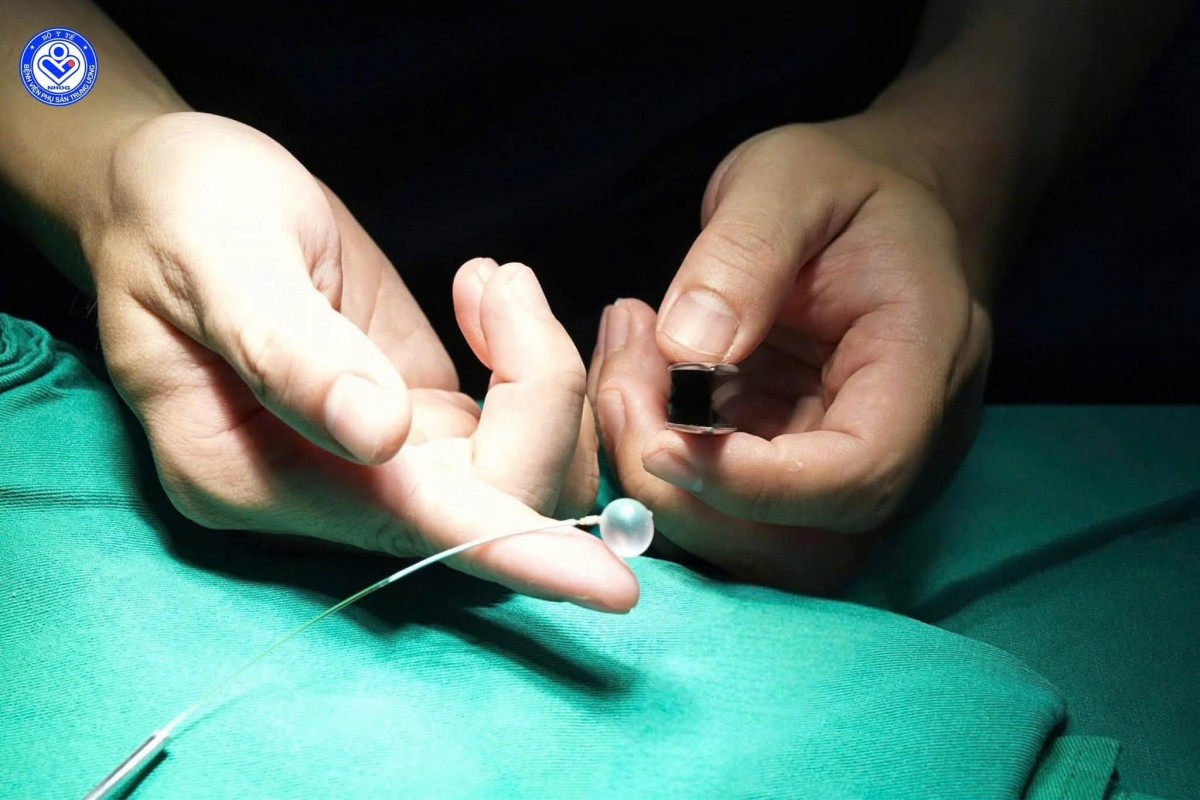 Quả bóng Lần đầu Việt Nam thực hiện thành công kỹ thuật FETO cho thai nhi