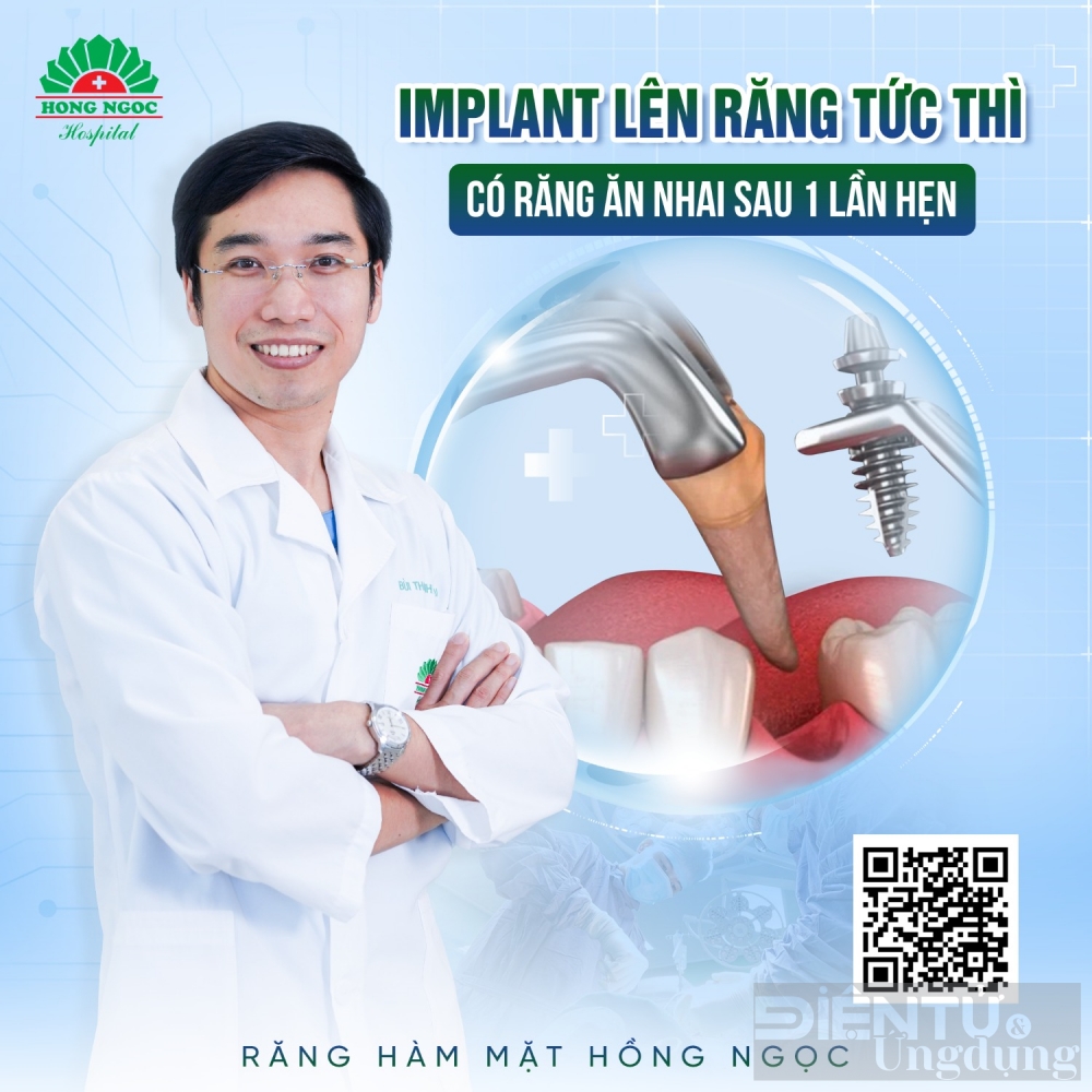 Đột phá công nghệ trồng răng Implant thế kỷ 21