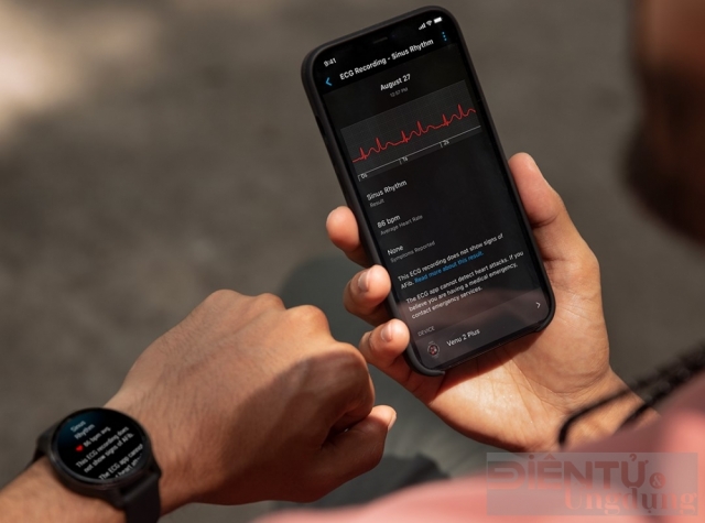 Điện tâm đồ ECG trên đồng hồ Garmin có tác dụng gì?