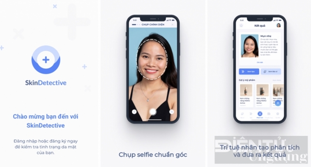 Skin Detective sử dụng AI để chẩn đoán các bệnh về da